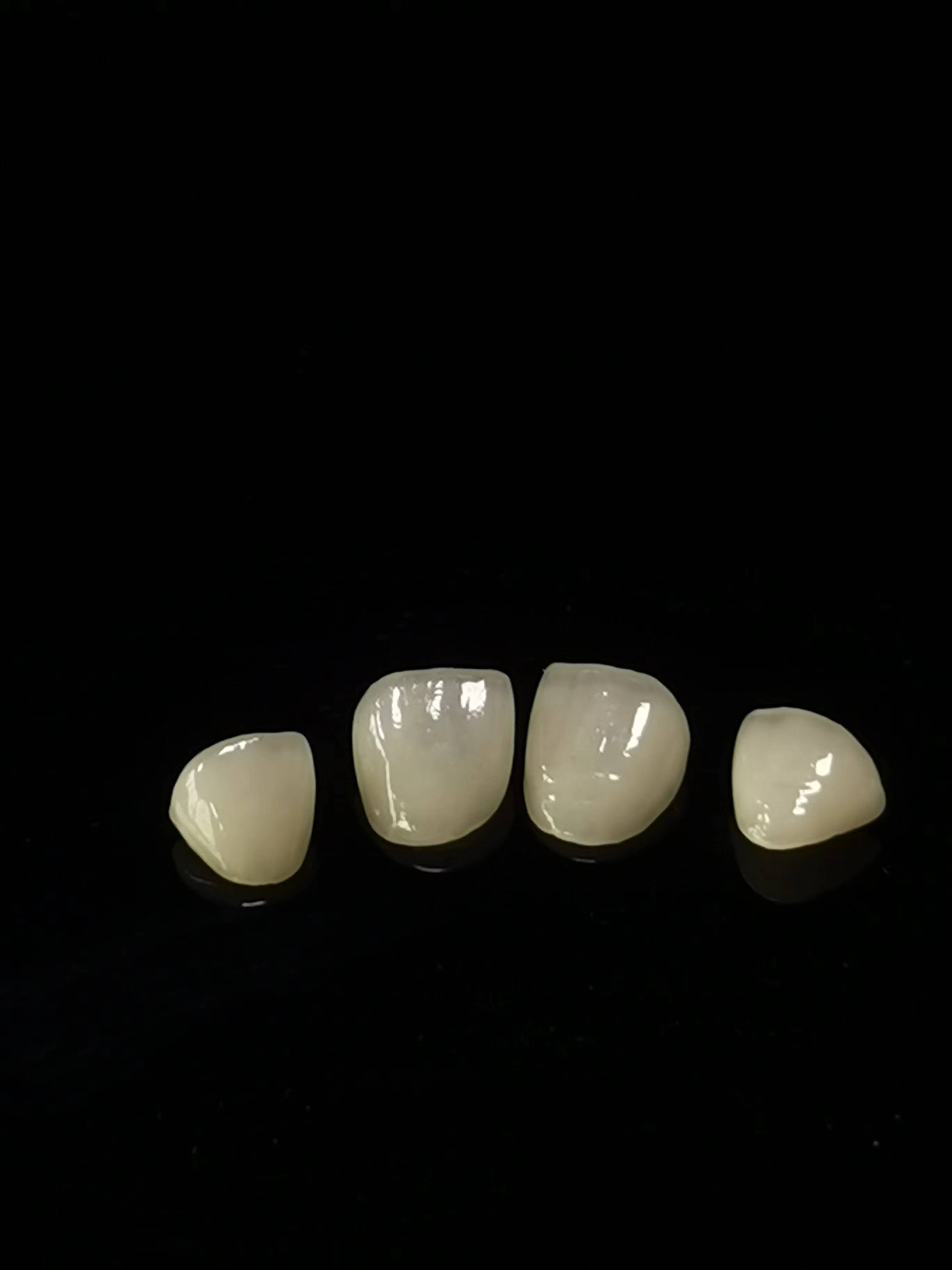Laboratorium dentystyczne E.max Praca
