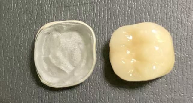 Jakie warunki są wymagane do uzyskania koron porcelanowych do metalowych?