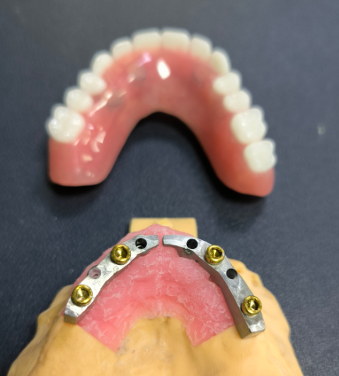 Lokalizator i tytanowa listwa dentystyczna