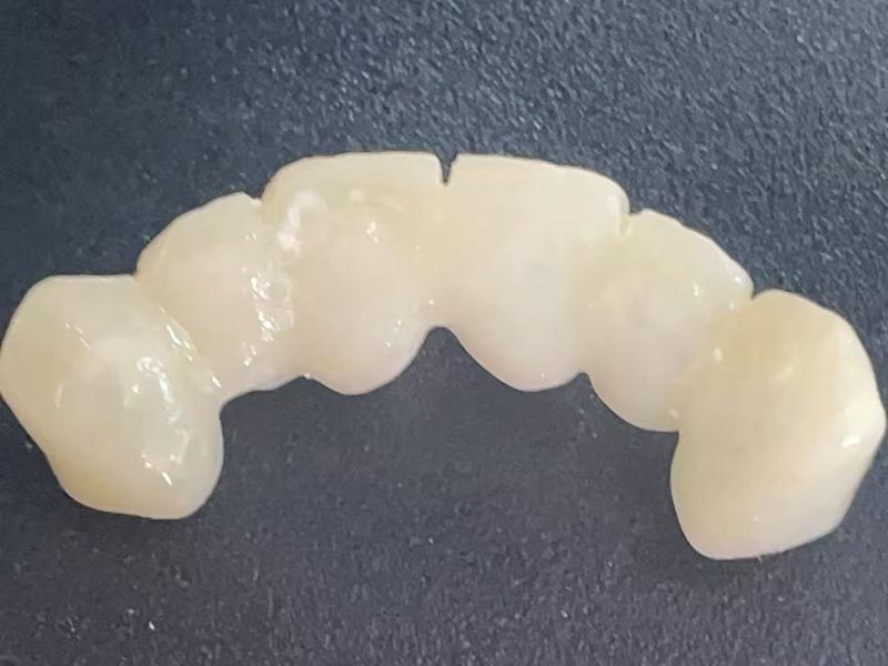 Co to jest „korona tymczasowa”? Dlaczego go potrzebujesz?