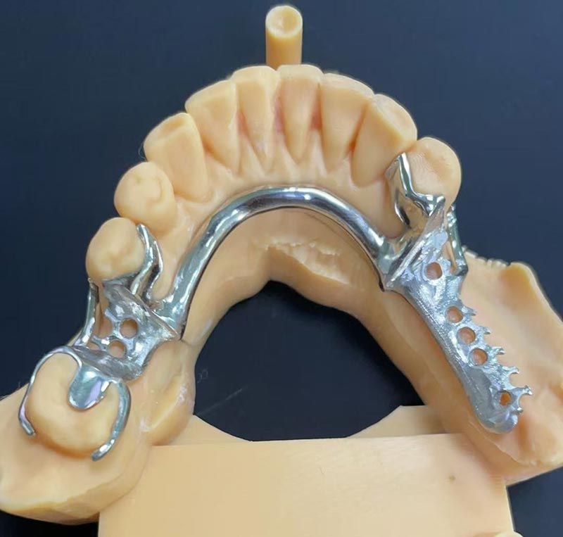 Zalety platformy kobaltowo-chromowej (rama Co Cr)
