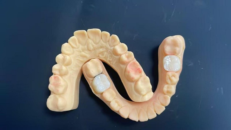 Jaka jest krawędź barku?