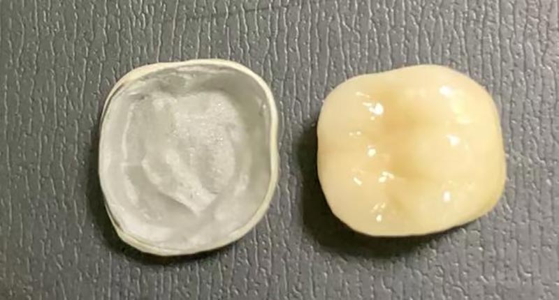 WM DENTAL LAB – Wiodące chińskie laboratorium dentystyczne