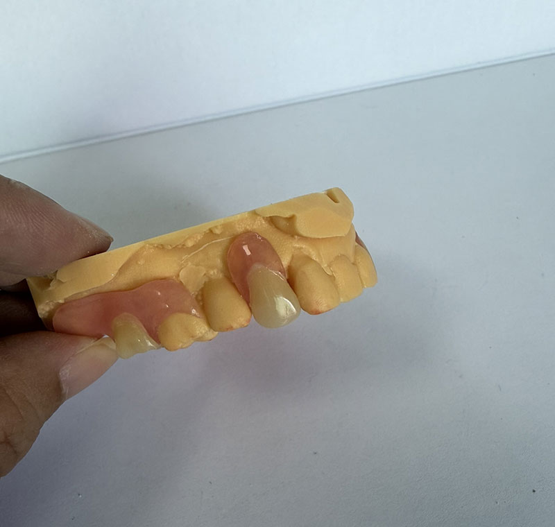 Części Valplast w laboratorium dentystycznym WM