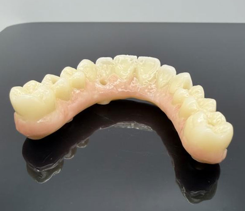 Typowe materiały na korony i mosty dentystyczne