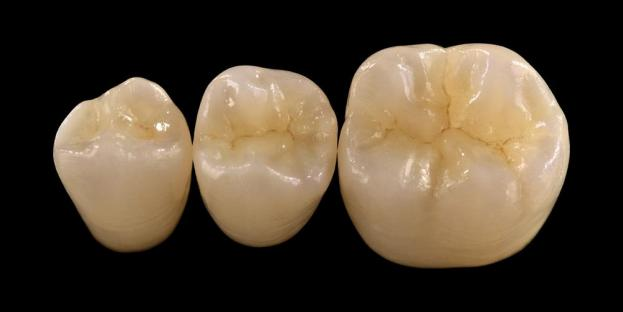 <h2>Tlenek cyrkonu w stomatologii: wskazania, zalety i względy kliniczne</h2>
<p>Cyrkon jest powszechnie uznawany za swoją wytrzymałość i trwałość. Najnowsze generacje materiałów cyrkonowych oferują również znacznie ulepszone właściwości estetyczne. W przypadku pacjentów rozważających odbudowę pełnoceramiczną niezwykle istotna jest dokładna ocena zarówno wskazań, jak i ograniczeń stosowania systemów na bazie tlenku cyrkonu.</p>
<p>Współcześni pacjenci coraz częściej oczekują uzupełnień, które łączą w sobie doskonałą estetykę z pełną funkcjonalnością. Większość nowoczesnych systemów ceramicznych może spełnić te oczekiwania, ale sukces kliniczny w dużej mierze zależy od właściwego doboru materiału, przygotowania zęba i protokołów cementowania. Przy wyborze należy kierować się kluczowymi właściwościami materiału, takimi jak odporność na pękanie, wytrzymałość na zginanie, odporność na zużycie i długoterminowa stabilność. Wśród tych materiałów tlenek cyrkonu stał się jedną z najczęściej stosowanych opcji we współczesnej stomatologii odtwórczej.</p>
<h3>Dlaczego warto wybrać cyrkonię?</h3>
<p>Cyrkon jest ceniony za wyjątkową wytrzymałość i długoterminową trwałość. Współczesny tlenek cyrkonu znacznie różni się od wcześniejszych generacji, które były bardziej nieprzezroczyste i mniej estetyczne. Obecnie technologia CAD/CAM umożliwia precyzyjne wykonywanie uzupełnień z tlenku cyrkonu o ulepszonych właściwościach optycznych.</p>
<p>Uzupełnienia można zaprojektować jako:</p>
<ul>
<li><strong>Cyrkonia monolityczna:</strong>Idealny do koron i mostów w odcinku bocznym, zapewnia wysoką wytrzymałość i trwałość.</li>
<li><strong>Warstwowa cyrkonia:</strong>Nadaje się do przypadków wymagających zwiększonej estetyki, w tym do uzupełnień o dużej rozpiętości w różnych obszarach jamy ustnej.</li>
</ul>
<p>Wytrzymałość na zginanie różni się w zależności od rodzaju i waha się od około 590 MPa w przypadku tlenku cyrkonu o wysokiej przezroczystości do 1400 MPa w formach monolitycznych. Uzupełnienia z tlenku cyrkonu można cementować przy użyciu samoadhezyjnych cementów na bazie żywicy lub cementów glasjonomerowych modyfikowanych żywicą.</p>
<h3>Kluczowe czynniki przy wyborze materiału na tlenek cyrkonu</h3>
<p>Rozważając zastosowanie tlenku cyrkonu w uzupełnieniu pełnoceramicznym, klinicyści powinni ocenić kilka kluczowych czynników:</p>
<ul>
<li>Pozostała struktura zęba</li>
<li>Lokalizacja w jamie ustnej (strefa estetyczna vs strefa funkcjonalna)</li>
<li>Obecność nawyków parafunkcyjnych, takich jak bruksizm</li>
<li>Przezierność sąsiadujących zębów naturalnych</li>
<li>Kolor i stan podstawowej struktury zęba</li>
</ul>
<p>Strefa estetyczna zazwyczaj obejmuje zęby przednie, chociaż u niektórych pacjentów może sięgać do pierwszego zęba trzonowego, w zależności od linii uśmiechu i dynamiki twarzy. Strefa funkcjonalna obejmuje na ogół zęby przedtrzonowe i trzonowe, gdzie siły okluzyjne są znacznie większe.</p>
<h3>Zastosowania Strefy Funkcjonalnej</h3>
<p>W obszarach tylnych należy dokładnie rozważyć siły okluzyjne. Cyrkon jest doskonałą alternatywą dla tradycyjnych uzupełnień PFM, szczególnie w przypadkach, w których przestrzeń na odbudowę jest ograniczona. Nowoczesny monolityczny tlenek cyrkonu pozwala na pełnokonturowe projektowanie anatomii zgryzu, w tym funkcjonalnych guzków i krawędzi brzeżnych, przy jednoczesnym zachowaniu wysokiej wytrzymałości.</p>
<p>Aktualne dowody wskazują, że monolityczny tlenek cyrkonu dobrze nadaje się na korony w odcinku bocznym i mosty wielopunktowe ze względu na doskonałą odporność na złamania i zużycie. Postępy w technikach adhezyjnych i projektowaniu preparatów poprawiły również długoterminowe wyniki kliniczne.</p>
<h3>Zastosowania w strefie estetycznej</h3>
<p>W odcinku przednim uzupełnienia muszą dokładnie odwzorowywać naturalny kolor zęba, przezierność i zachowanie światła. Chociaż materiały takie jak dwukrzemian litu oferują doskonałą estetykę, są słabsze i zazwyczaj wymagają klejenia.</p>
<p>Kluczową zaletą tlenku cyrkonu jest możliwość konwencjonalnego cementowania przy jednoczesnym zachowaniu wysokich parametrów estetycznych. Wraz z rozwojem wielowarstwowych systemów tlenku cyrkonu o wysokiej przezierności możliwe jest obecnie wykonywanie uzupełnień ściśle naśladujących naturalne uzębienie.</p>
<p>Zaawansowane techniki przetwarzania dodatkowo poprawiają właściwości optyczne i redukują niedoskonałości, które mogą mieć wpływ na transmisję światła i wygląd.</p>
<h3>Połączenie siły i estetyki</h3>
<p>Wczesne systemy tlenku cyrkonu traktowały priorytetowo wytrzymałość, ale brakowało im jakości estetycznej. Nowoczesny monolityczny tlenek cyrkonu z powodzeniem łączy w sobie zarówno wytrzymałość, jak i lepszy wygląd, dzięki czemu nadaje się do szerokiego zakresu przypadków klinicznych.</p>
<p>Jest to szczególnie korzystne dla pacjentów z nawykami parafunkcjonalnymi lub wcześniejszymi niepowodzeniami odbudowy. Badania kliniczne wskazują na wysoką akceptację pacjentów i niski odsetek powikłań.</p>
<p>Obawy dotyczące zużycia przeciwstawnych zębów zostały zmniejszone dzięki nowszym formułom. Wysoko wypolerowane powierzchnie tlenku cyrkonu wykazują niski potencjał ścierny, a w niektórych przypadkach mogą być delikatniejsze niż tradycyjne uzupełnienia napawane porcelaną na metal.</p>
<h3>Implanty cyrkonowe: pojawiająca się alternatywa</h3>
<p>Podczas gdy implanty tytanowe pozostają standardem klinicznym, implanty cyrkonowe zyskują na popularności jako alternatywa niezawierająca metalu. Wczesne projekty były głównie systemami jednoczęściowymi, ale obecnie dwuczęściowe implanty cyrkonowe pozwalają na lepszą elastyczność protetyczną.</p>
<p>Implanty cyrkonowe są szczególnie przydatne w przypadkach, gdy istnieją obawy natury estetycznej, takie jak potencjalne szare przebarwienie tkanek wokół implantu lub cienki biotyp dziąseł. Można je również rozważyć u pacjentów z rzadką nadwrażliwością na tytan.</p>
<p>Jednakże implanty cyrkonowe są wciąż stosunkowo nowe, a długoterminowe dane kliniczne w porównaniu z systemami tytanowymi są ograniczone.</p>
<h3>Wniosek</h3>
<p>Cyrkon stał się bardzo wszechstronnym materiałem w stomatologii odtwórczej, oferującym silną równowagę pomiędzy wydajnością mechaniczną a estetyką. Właściwy dobór przypadków i przestrzeganie protokołów klinicznych są niezbędne do osiągnięcia optymalnych wyników zarówno w odcinku przednim, jak i tylnym.</p>