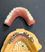 Lokalizator i drążek dentystyczny