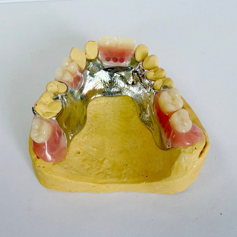 Częściowa rama do odbudowy zdejmowana